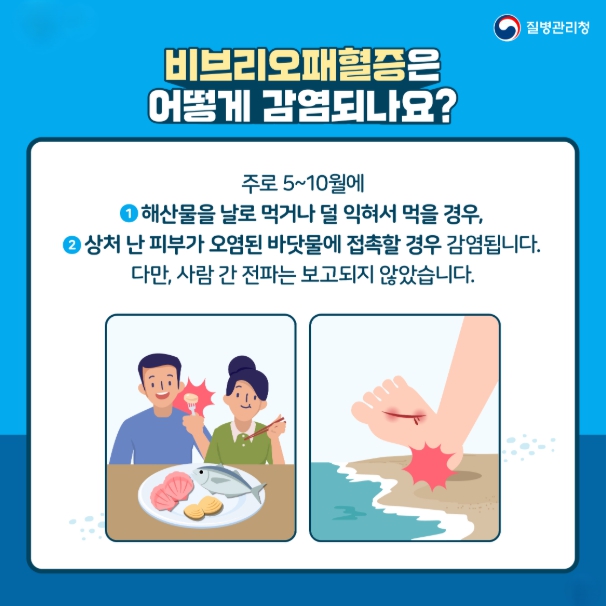 경남도, 어패류 생식·바닷물 접촉 조심! 여름철 ‘비브리오패혈증’ 주의하세요