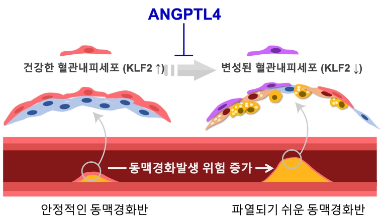 전남대 안영근 교수팀, 동맥경화 예방 새로운 원리 규명